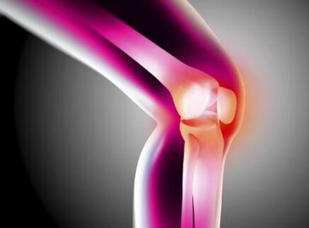Deforming joint diseases
