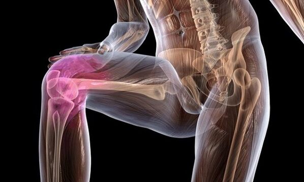Signs and symptoms of knee joint disease