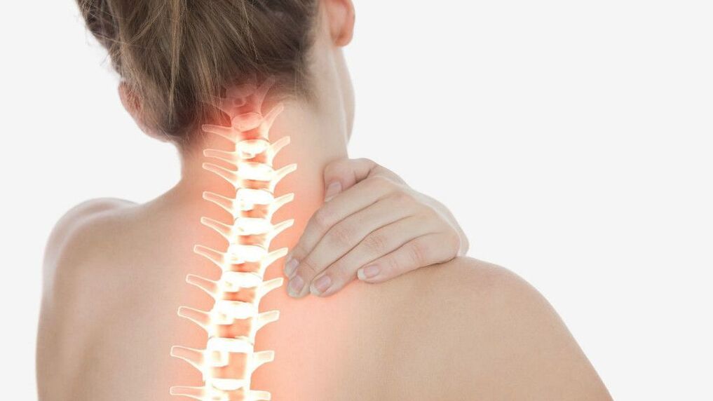 Neck pain due to cervical spondylosis