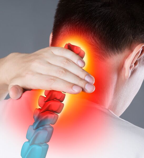 neck pain due to cervical bone necrosis