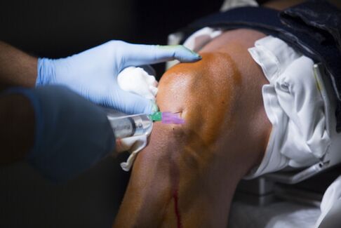 Injections of the knee to treat joint disease